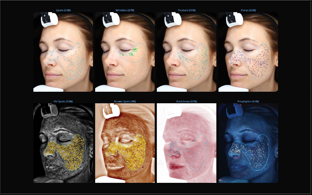 Poliklinika Bagatin VISIA uređaj za analizu kože