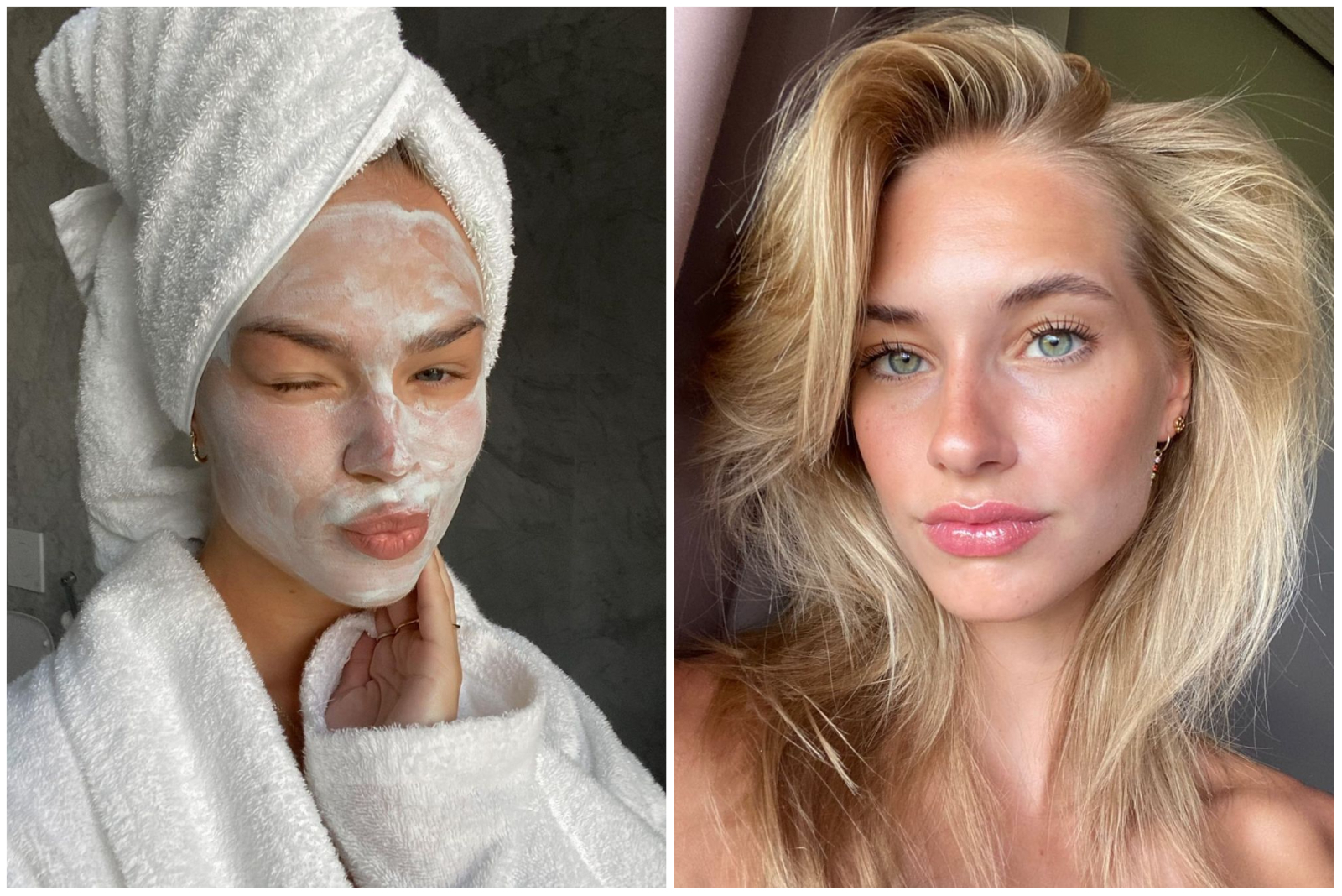 Skincare trik uz koji ćete izvući najbolje od hijaluronske kiseline i dobiti blistavu kožu