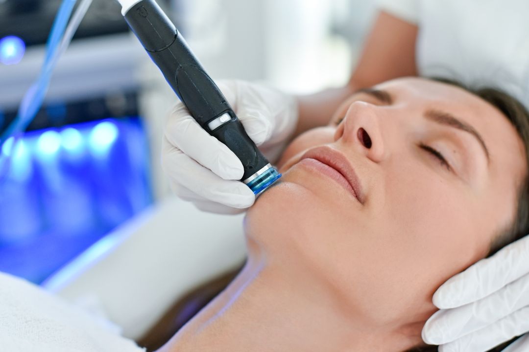 HydraFacial Bagatin