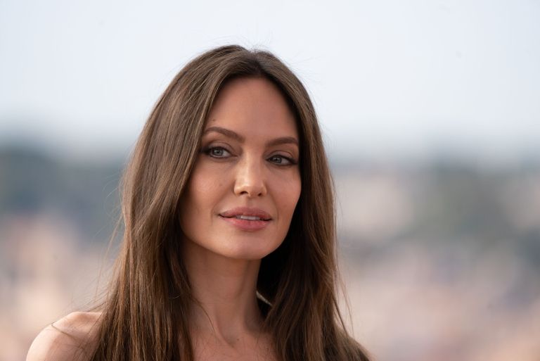 Buccal fat removal, Angelina Jolie, Profimedia