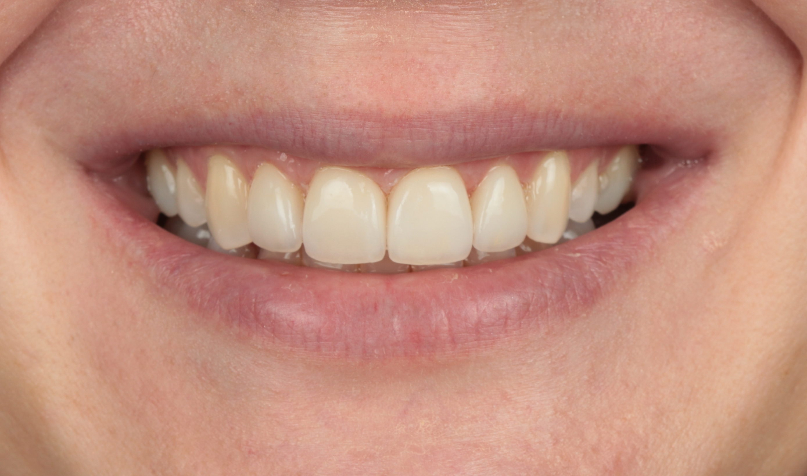 dental sandev_poslije