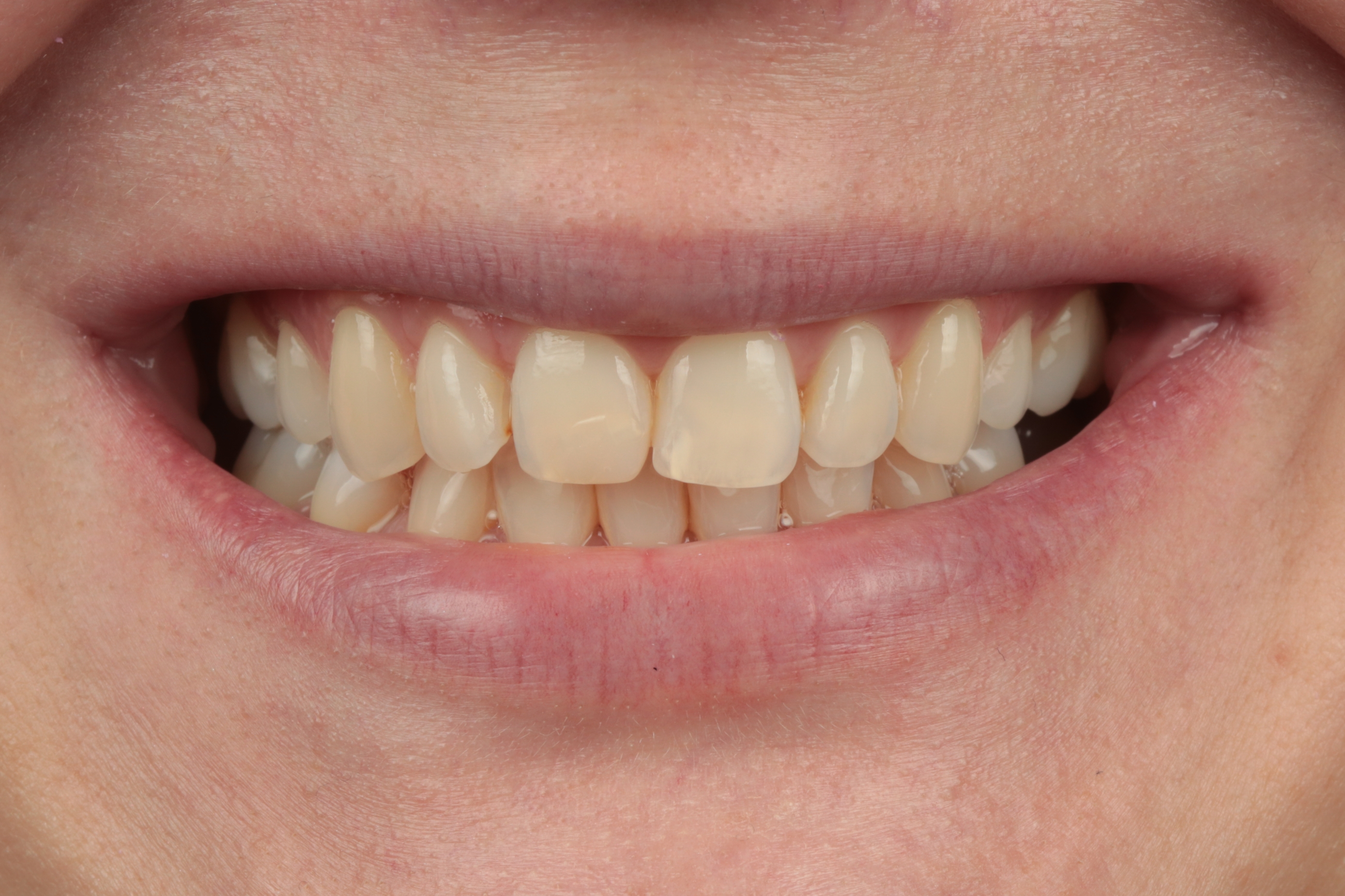 dental sandev_Prije 5