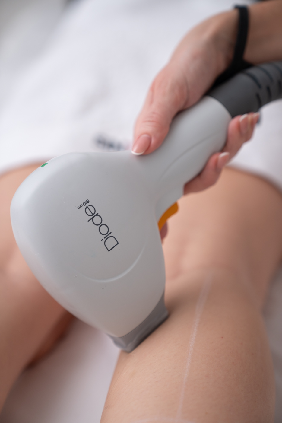 Sinteza Skin Clinic_lasersko uklanjanje dlačica (1)